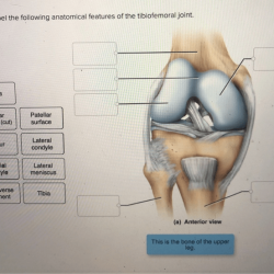 Correctly label the following anatomical features of the tibiofemoral joint