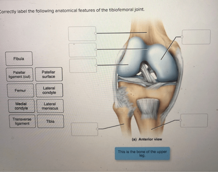 Correctly label the following anatomical features of the tibiofemoral joint