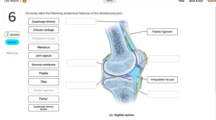 Correctly label the following anatomical features of the tibiofemoral joint