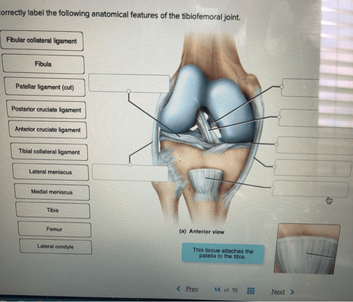 Anatomical correctly tibiofemoral joint transcribed